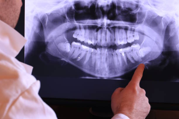 Best Knocked-Out Tooth Emergency  in Lakeview, MI
