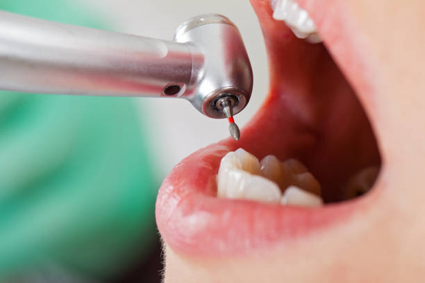 Best Emergency Gum Pain Relief  in Lakeview, MI
